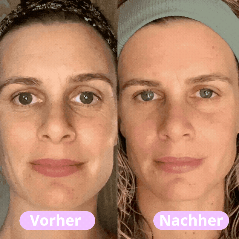 Straffendes LED-Gesichtsmassagegerät